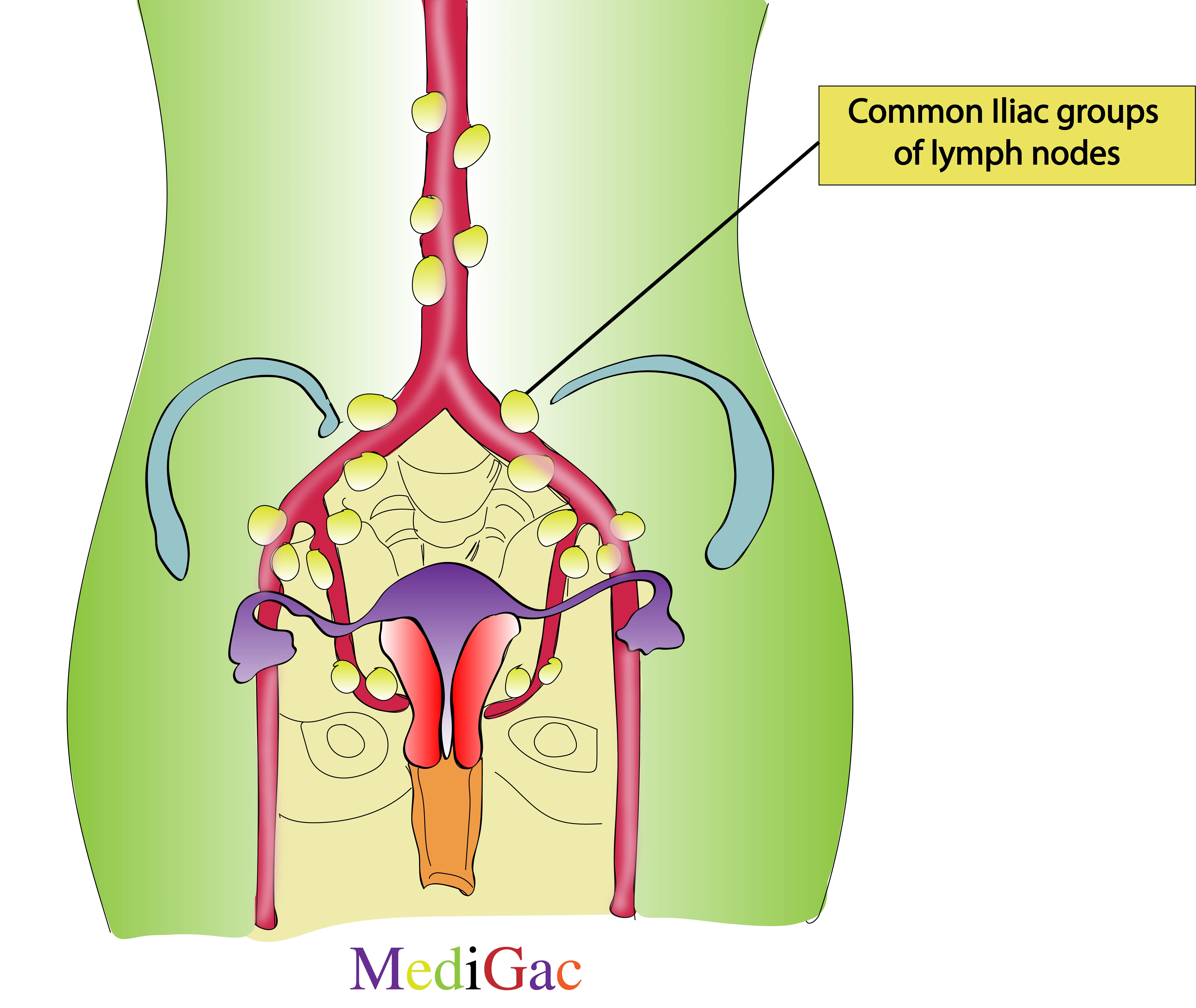 Common iliac lymph nodes